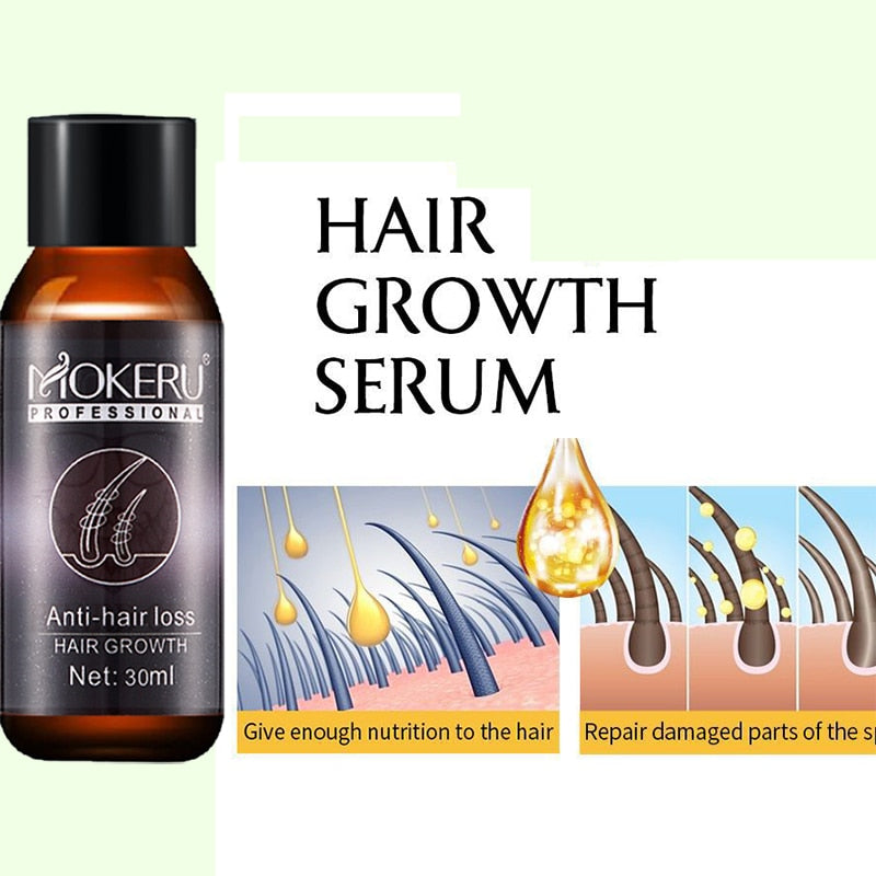 Anti Hair Loss Oil  Hair Growth Treatment